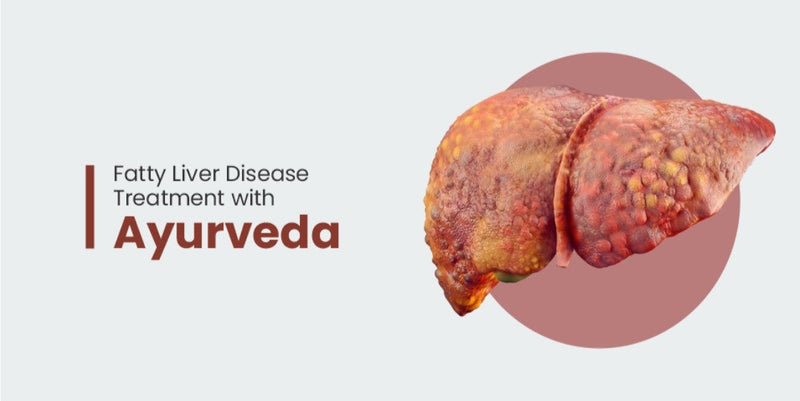 Reclaiming Liver Health: Ayurvedic Solutions for Fatty Liver Worries