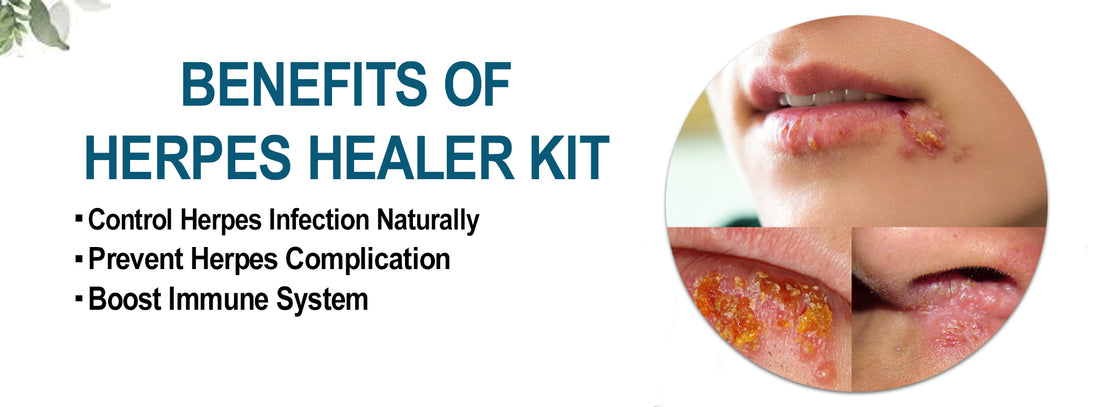 Herpes Healer Kit