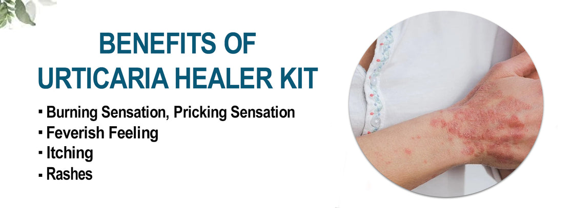 Urticaria Healer Kit